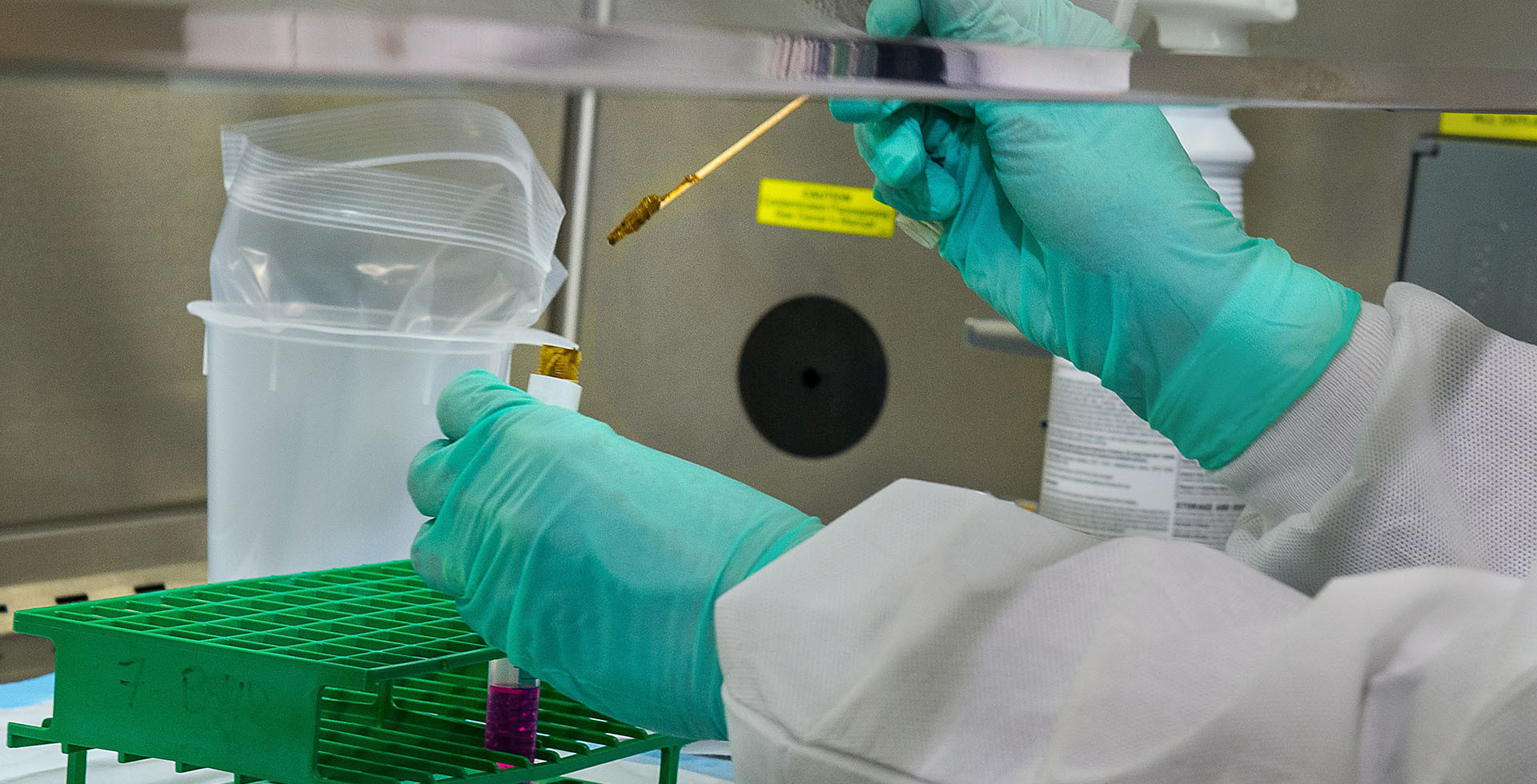 How wastewater can prepare hospitals for a resurgence of the pandemic